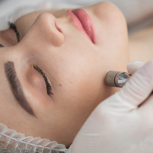 Microdermabrasion (one hour)